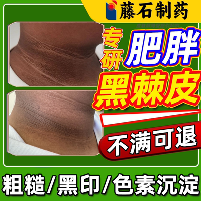 【药监备案】脖子黑棘皮色素沉积