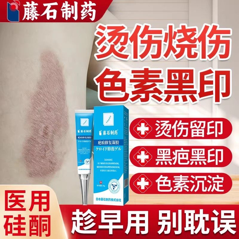 烫伤烧伤疤痕修复除疤膏去黑印色素沉淀油烫伤淡化疤印去伤疤WQ