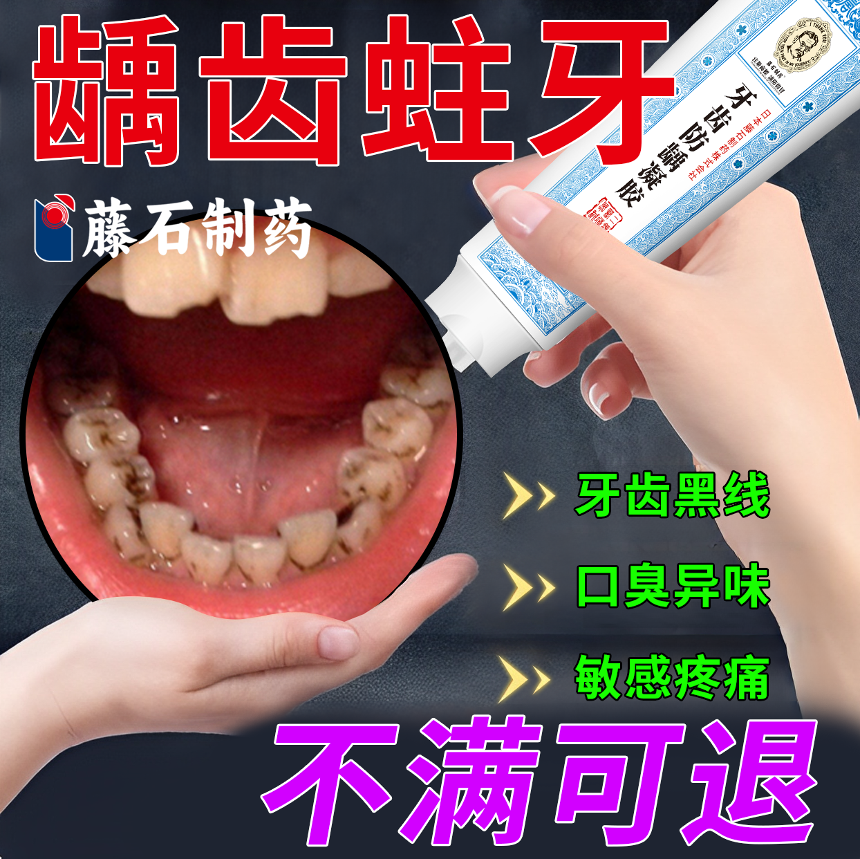 医用型防蛀牙虫牙专用修儿童龋齿补牙缝复非牙膏去黑线官方正品Y8