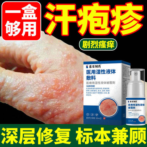 藤石医用湿性液体敷料汗状疱疹