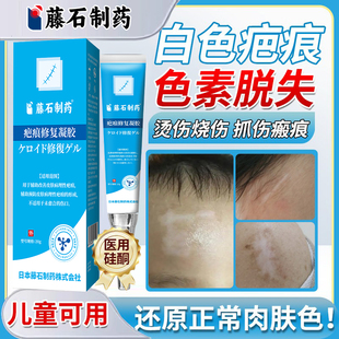 白色疤痕色素脱失修复伤疤去除摔伤烧伤烫伤沉淀硅酮祛疤膏儿童VQ