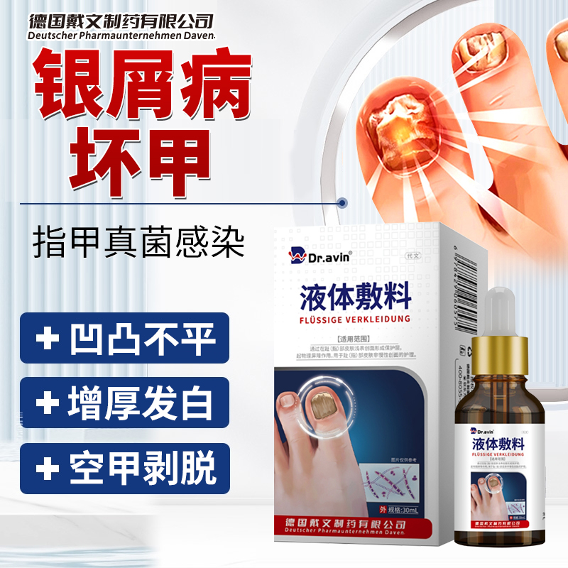 银屑病甲指甲真菌感染剥离发黄增厚凹凸不平指甲修复液药房同款YM