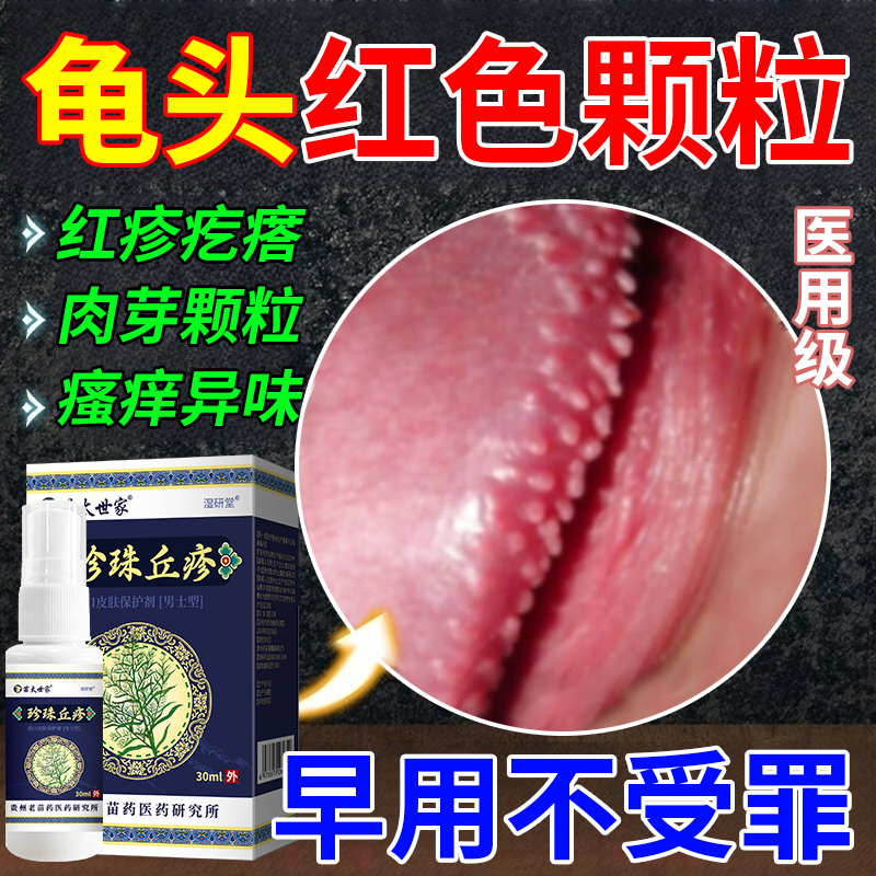 龟头红色颗粒龟头皮水泡下面阴茎珍珠丘疹冠状沟珍珠疹疙瘩去除wy