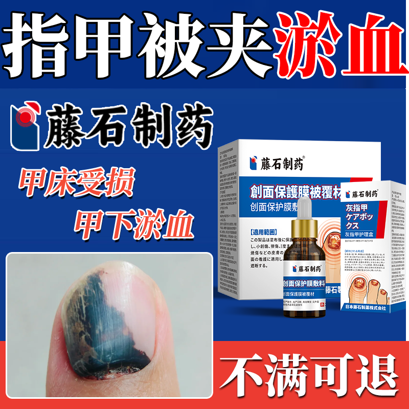 【藤石制药】指甲被夹坏死淤血