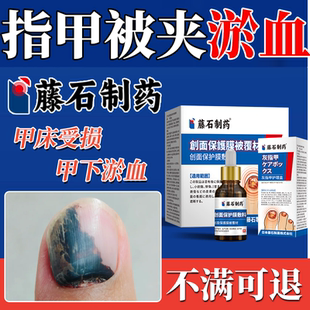 手脚指甲盖被门夹被砸挤淤血甲床修复生长液受伤受损再生养甲床YY