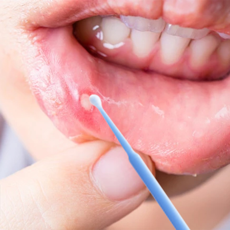 正风林点涂棒上药工具（仅点涂棒，不含正风林产品）