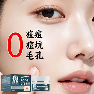 【专攻瑕疵】0豆坑0豆豆0豆印自然长平祛痘膏坑凹洞修护推荐护理
