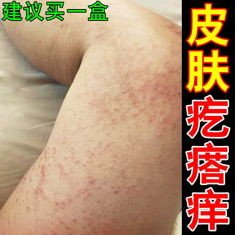 身上痒起红疙瘩痒腿部皮肤过敏起小红点痒小腿长痘痘痒痒的抓出血