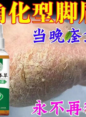 角化型脚气喷雾止痒脱皮烂脚丫真菌感染手足藓脚后跟增厚硬化干裂