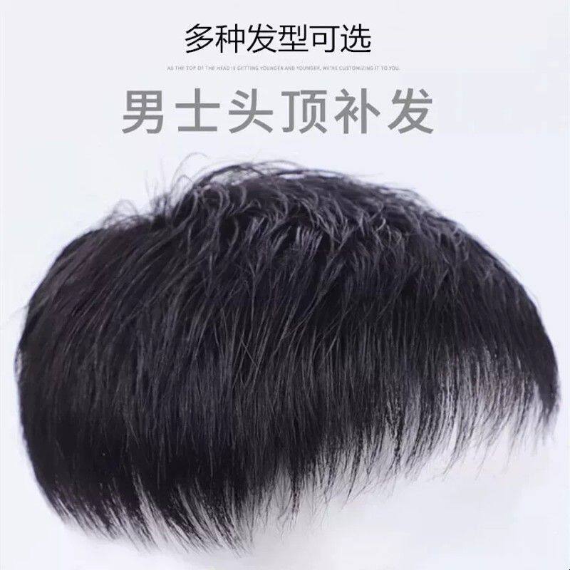 男士假发片头顶补发块秃顶地中海男士前额补发自然真发假发片整顶