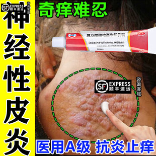 复方醋酸地塞米松乳膏过敏皮炎瘙痒止痒药膏湿疹软膏皮肤抑菌药膏