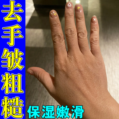 手上皱纹护手霜淡化手纹补水保湿粗糙嫩肤祛手指关节皱纹软膏