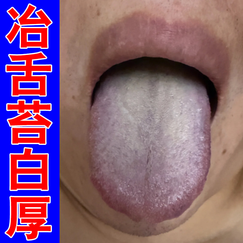 冶舌苔白厚口干口苦舌头发黄调理脾胃口干苦舌头有纹草本修护喷剂