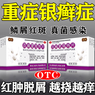 银屑病专用药治疗牛皮藓特口服效百癣夏塔热片正品止痒手足体癣药