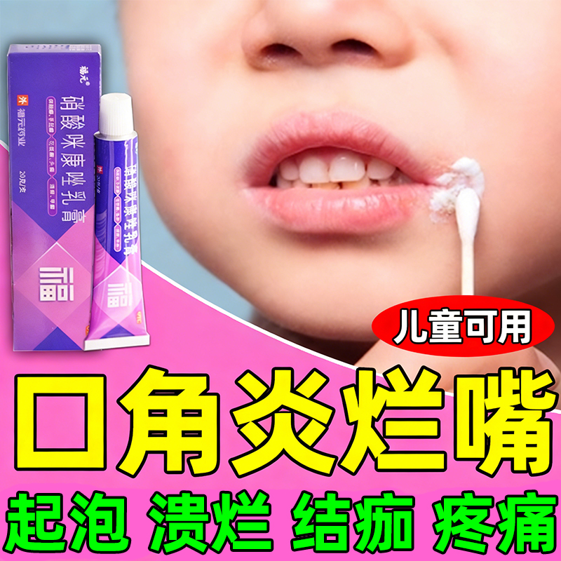 口角炎烂嘴角唇炎专用药膏