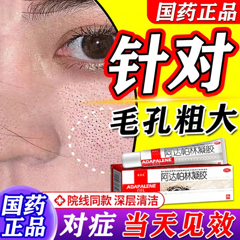 阿达帕林凝胶正品医用官方旗舰店毛孔粗大收缩修复脸部去角质黑头
