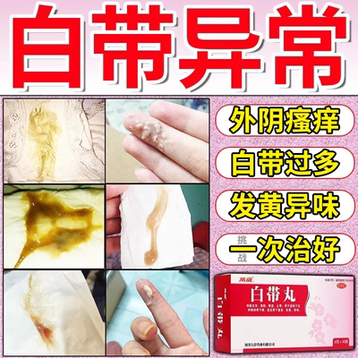 【朗致】白带丸6g*8袋/盒