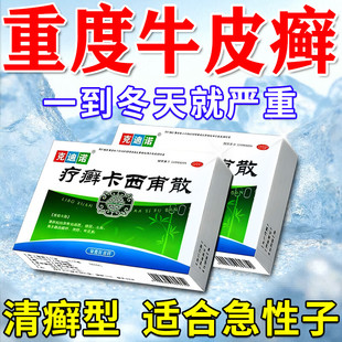 疗癣卡西甫散治银屑病牛皮癣皮肤瘙痒反复发作红肿脱屑止痒口服药