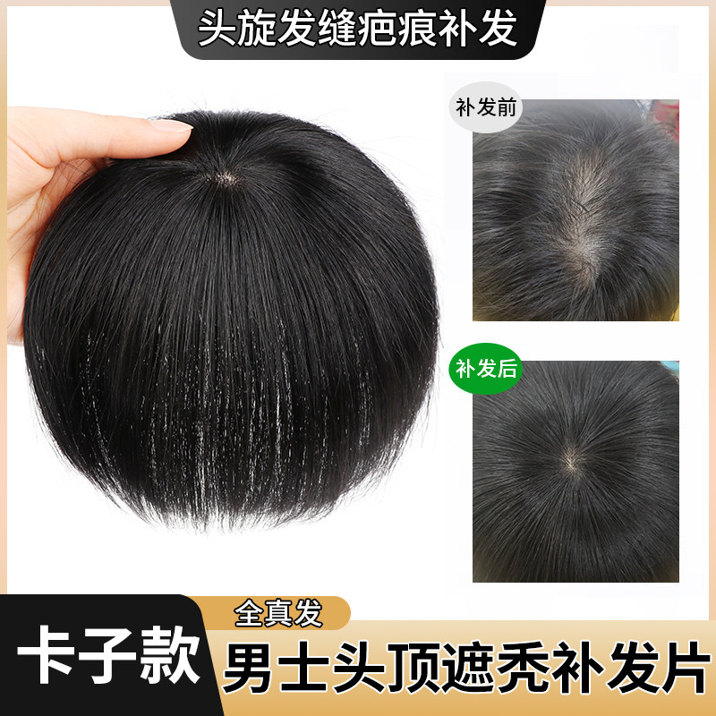 速发假脱男全真人发头旋发士男缝补发遮盖伤疤头顶部稀少发发假发