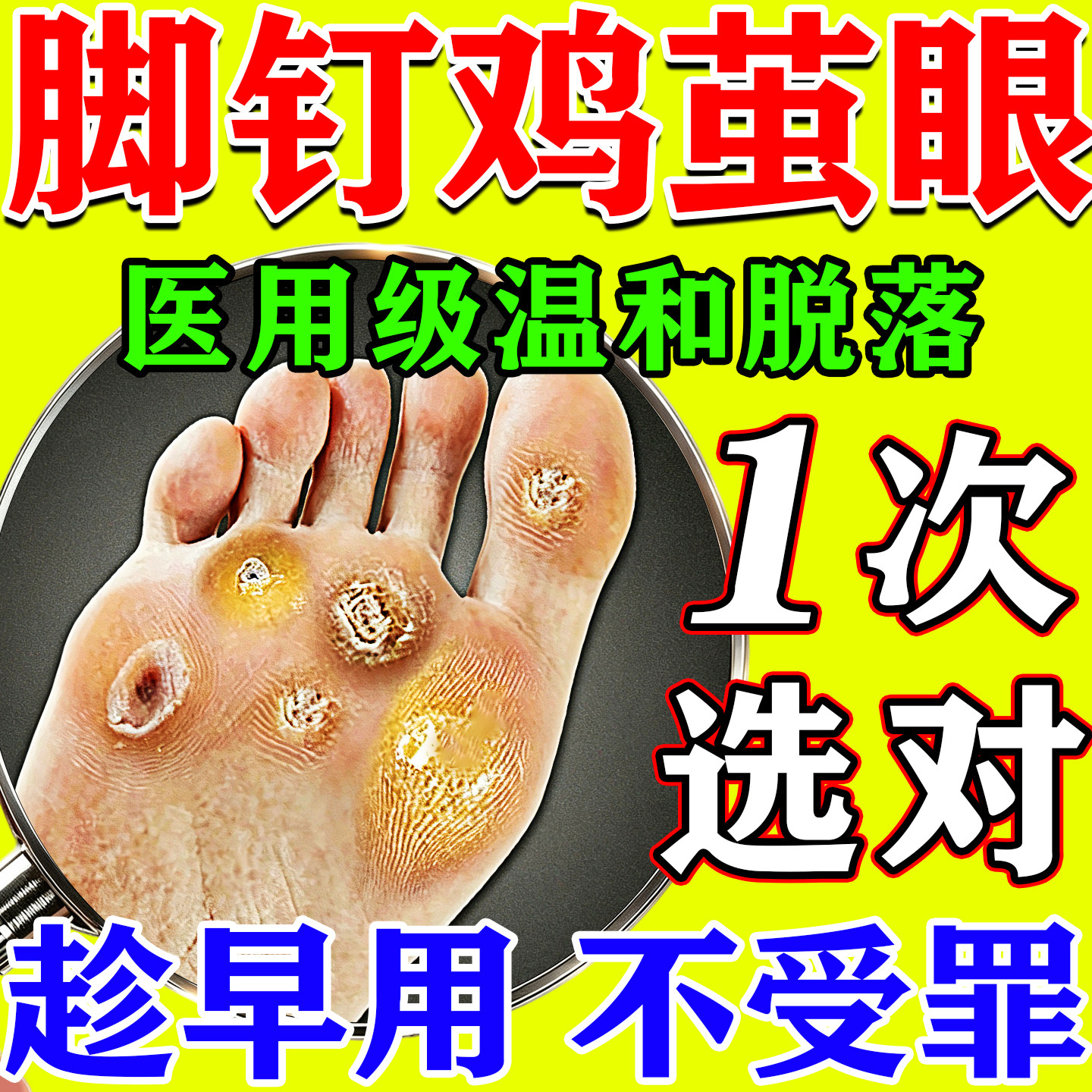 脚钉祛除贴足底老茧鸡眼无痛去除神器根软化厚脚垫硬疙瘩根专用膏