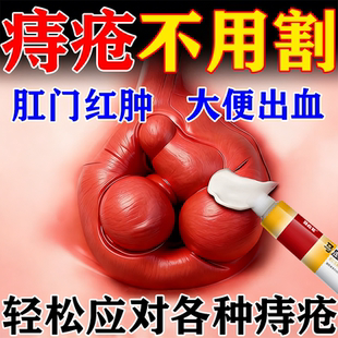 马应龙痔疮膏正品官方旗舰店痔疮膏消肉球肛裂愈合膏肛门瘙痒疼痛