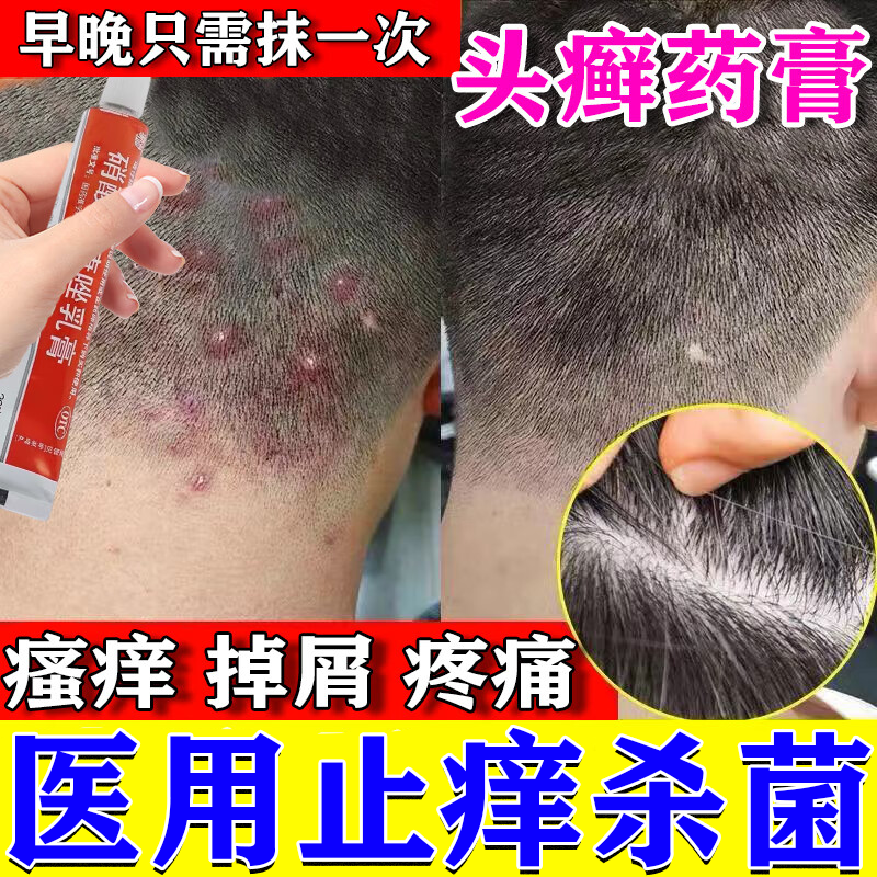 达克宁硝酸咪康唑软膏正品头皮屑脂溢性皮炎真菌感染头癣药膏,OTC药品/国际医药,癣症,淘宝优惠券,粉丝福利购,淘宝优惠卷