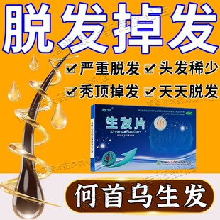 掉发严重吃什么何首乌除脂生发片脱发严重男女脱发生发增发密发药