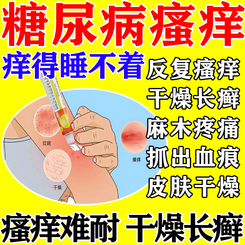 【嘉效】醋酸曲安奈德益康唑乳膏16.5mg150mg*20g*1支/盒