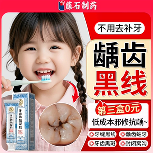 儿童牙齿非牙膏防蛀牙龋齿修复去黑线去除黑渍牙窝沟医用型含氟YS