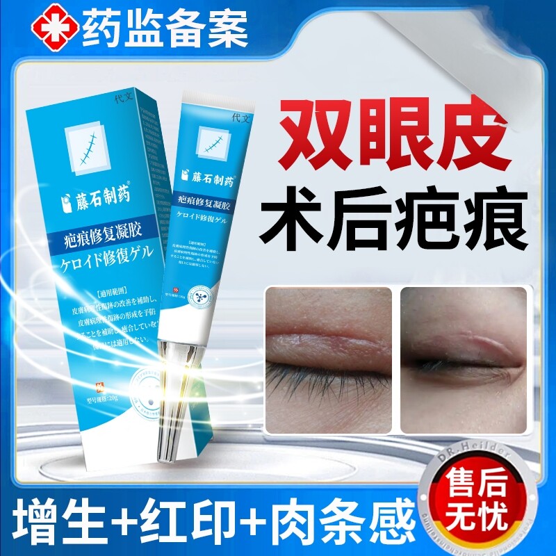 割双眼皮术后祛疤膏消肿神器增生凸起手术非疤痕贴开眼角去疤膏YS
