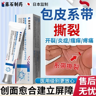 包皮系带撕裂开裂发炎裂口子瘙痒疼痛龟头炎真菌感染药房同款膏YS