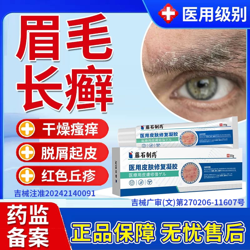 眉毛脂溢性皮炎面部起皮长癣脸上鼻翼子两侧干红痒脱皮掉屑凝胶MP