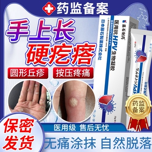 手上长硬疙瘩寻常疣去除神器刺猴瘊子甲周疣专去用根可搭膏药贴EM