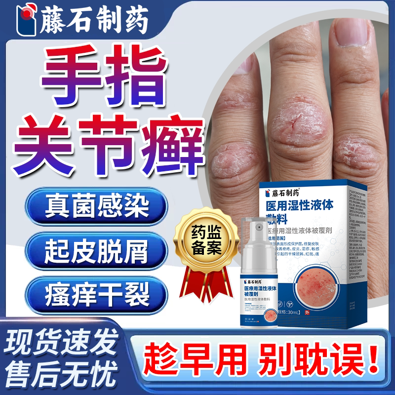 手指关节皮肤癣痒手癣膏手足特干裂效专用皮肤真菌感染藤石制薬LC