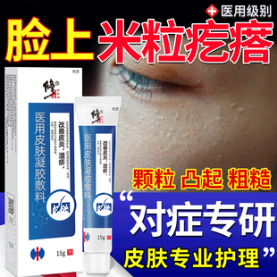 儿童面部鸡皮肤毛囊角化症专用膏医用青少年脸上小疙瘩药房同款