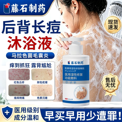 【医用级】去后背痘毛囊炎沐浴液