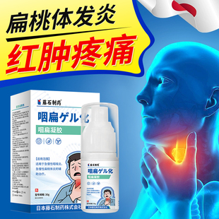 扁桃体发炎喉咙肿痛专用喷剂化脓性咽喉炎嗓子疼异物感药房同款YM
