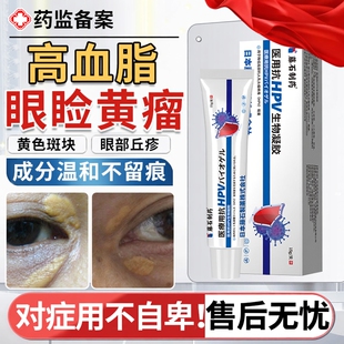 眼睑黄瘤去眼皮黄斑瘤专用膏眼角睑黄疣睑黄瘤去除非神器药房膏YS