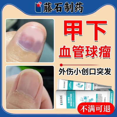 【速发】手指脚指甲下血溜红印子