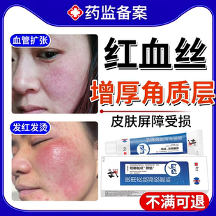 敏感肌修复脸上部泛红去红血丝面油修复角质层改善敏感肌肤增厚EM