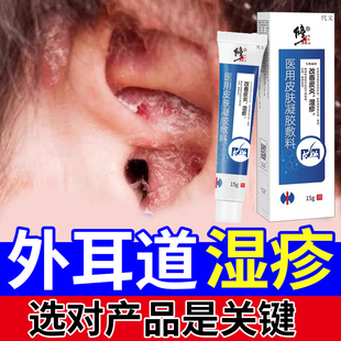外耳道湿疹耳朵湿疹专用真菌感染皮屑干燥起皮流脓结痂霉菌凝胶YM