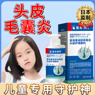 藤石制药儿童头皮毛囊炎头屑脂溢性皮炎真菌感染头癣喷剂洗发水YM