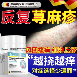 寻荨麻疹增强免疫力免疫球蛋白喷雾非进口中成药物断过敏根止痒YS