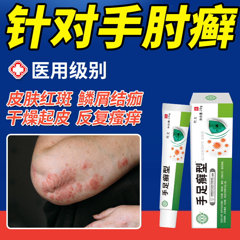 医用手肘癣手臂胳膊肘癣顽固性皮癣过敏止膏神经性皮炎痒专用pa