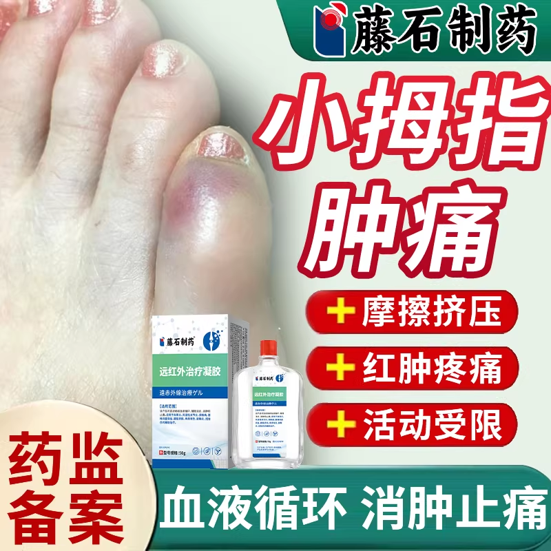 小脚指趾头外侧疼痛滑囊炎磨脚起泡防挤压关节红肿痛药房同款膏BS