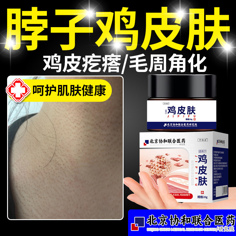脖子鸡皮肤去除小疙瘩毛孔堵塞疏通毛囊炎红点毛周角化症膏pa