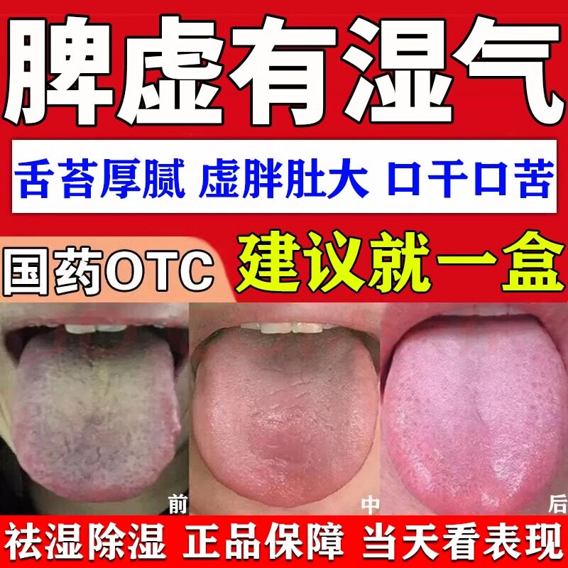 四君子合剂非太极官方旗舰店正品健脾祛湿气重肝火盛治疗脾胃虚弱