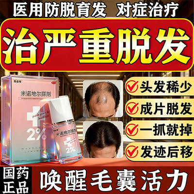 米诺地尔搽剂生发液正品旗舰店治脱发掉发防脱育发生发专用搽剂