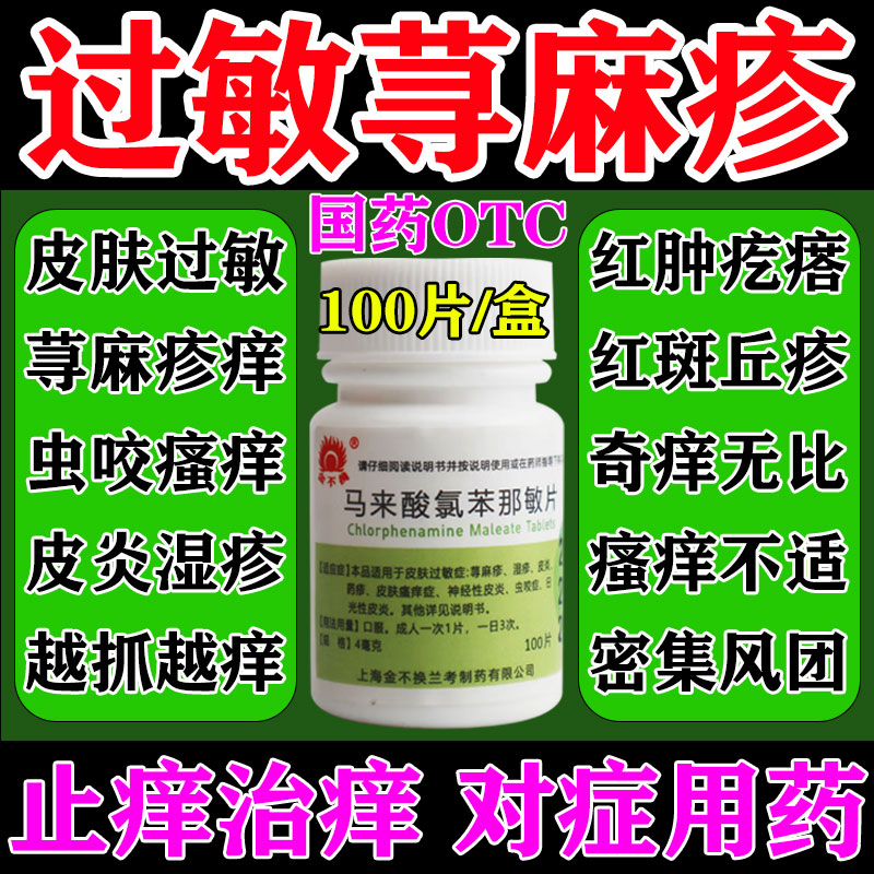 寻荨麻疹过敏止痒专用药