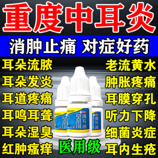中耳炎专用特疼效药可除耳根滴耳液耳朵消炎耳朵痒流脓流水滴耳油